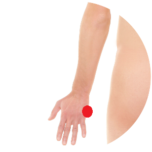 Dünndarm 3 liegt in der Handmuskulatur direkt unterhalb des Gelenks des kleinen Fingers.
