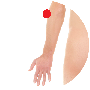 Der Punkt Dickdarm 10 befindet sich in einer natürlichen Vertiefung vor dem Ellenbogengelenk in der Unterarmmuskulatur.